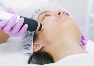 Gezichtsbehandeling microneedling razend populair in Twente, maar niet zonder risico’s