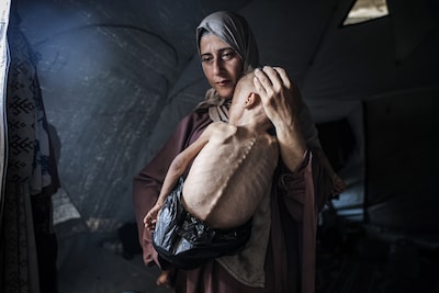 Ondervoed, of ligt het anders? Controver­se om schokkende foto uit Gaza van uitgemer­gel­d Muhammad (1)
