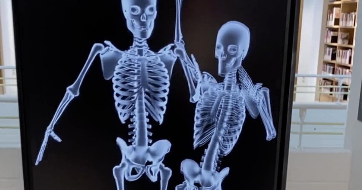 Beeld in ‘realtime’ laat bezoekers van expositie in CODA effect zien van röntgenstralen